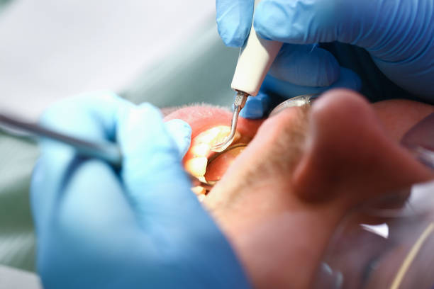 Best Mobile Emergency Dentist in Uhland, TX